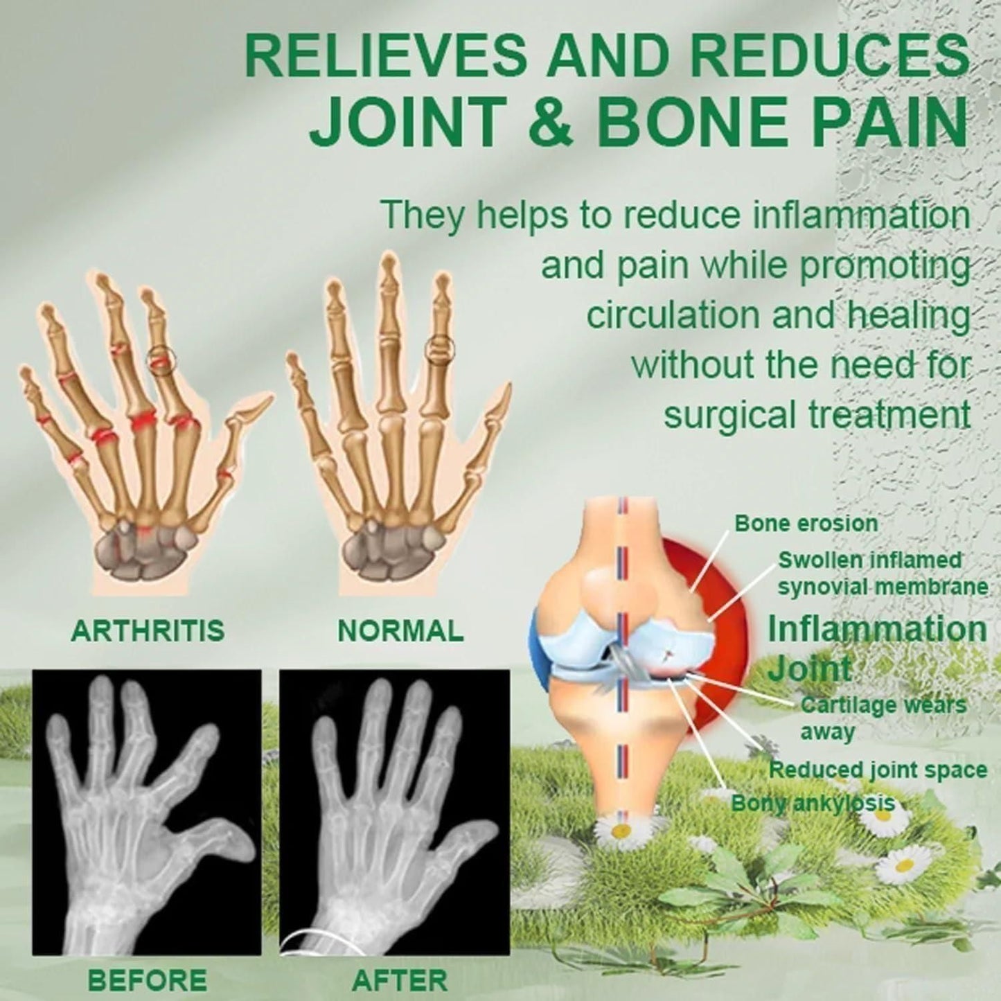 Bee Venom Joint & Bone Therapy Cream – Natural Pain Relief for Muscles & Joints (Pack of 3, 100g Each)